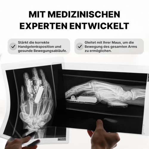 DELTAHUB Carpio 2.0 – Ergonomische Handgelenkauflage, Rechts, L, Schwarz